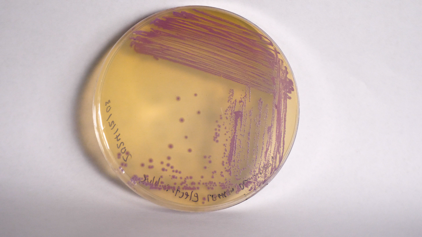 Electric blue | Plasmid